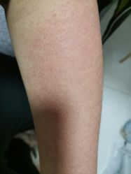 点击看大图 -标婷维生素E乳