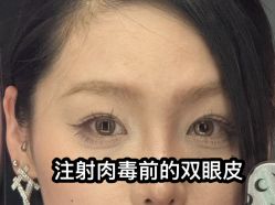-上海玫瑰医疗美容医院