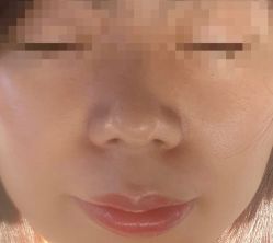 -厦门美莱整形美容医院