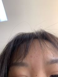 -小忠丽格医美