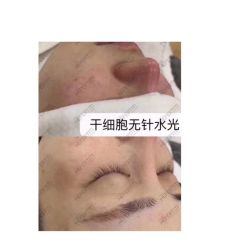 -첫번째 初见美学中心