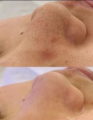 -春田皮肤管理中心品牌旗舰店