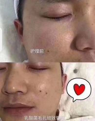 -SKIN79皮肤管理中心