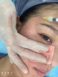 -天津健丽·去眼袋医疗美容机构