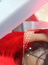 -碧莲盛·不剃发植发