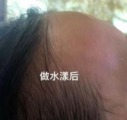 -丝域养发馆