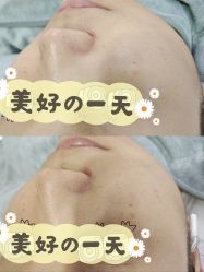 -SKIN79皮肤管理中心