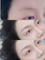 点击看大图 -久匠·纹眉半永久野生眉