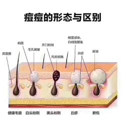 -痘院长·祛痘·皮肤管理