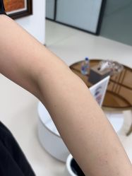 -薇兰专业脱毛连锁机构