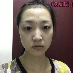 点击看大图 -新生植发·植养护一体