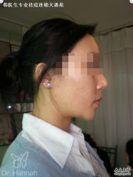 -韩医生专业祛痘连锁机构