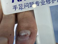 -Andrew指甲专科灰指甲·甲沟炎矫正·3D步态矫形鞋垫定制(浦三路店)