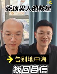 -唐风采假发补发定制