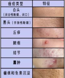-MLP美丽派·问题肌疗愈中心