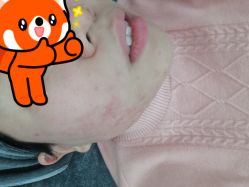 -ROYEA茹彦祛痘·问题肌肤修护中心