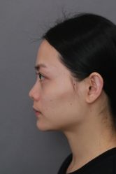 -北京米扬丽格医疗美容·联合丽格鼻整形中心