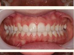 -佛山中大口腔医院·市二级口腔专科医院