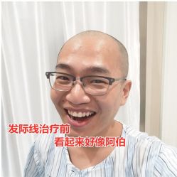 -碧莲盛·不剃发植发