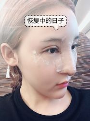 -素美医疗美容·西南眼鼻整形·修复基地