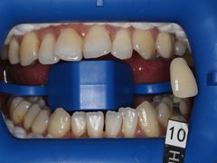 -齐玉齿科JADENTAL