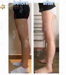 -贝黎诗SPA
