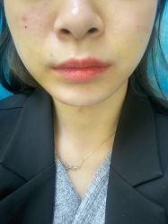 体验后-联合丽格·张菡丽格医疗美容