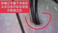 -菩叶脱发白发中心