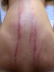 -艾尚灸头道汤养生馆