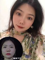 -Yestar重庆艺星医疗美容医院
