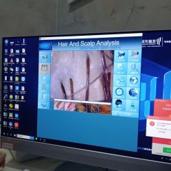 -雍禾植发全国连锁