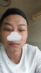 -万州华美紫馨整形美容医院