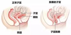 -邢台妇产医院