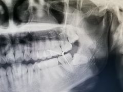 -钜成口腔(师范大学一部店)