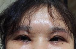 体验后-成都西区医院整形美容