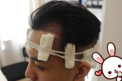 -大麦微针植发丨全国连锁