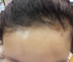 -厦门美莱整形美容医院