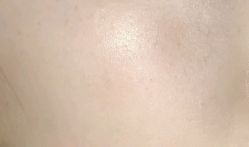 -斐尔国际皮肤管理中心