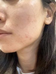 -北京叶子整形美容医院
