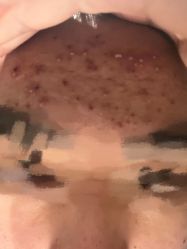 -元熙兰积皮肤管理