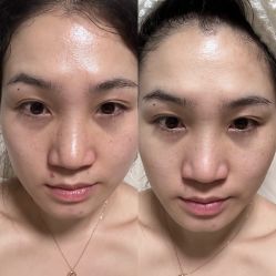 体验前-亿美医疗美容·半岛大超炮官方授权店