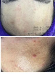 -蕾特恩专业祛痘·皮肤管理