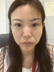 -八大处整形