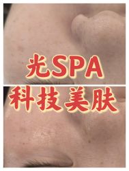 -光SPA科技美肤