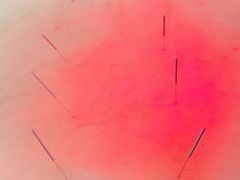 -北京中医药大学附属护国寺中医医院(住院院区)