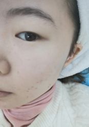 体验前-贞禾医美·连锁