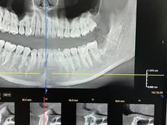 -牙博士口腔品牌连锁(杨浦店)