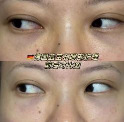 -春田皮肤管理中心品牌旗舰店