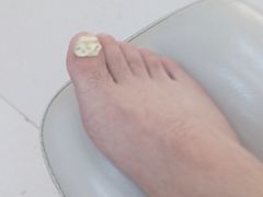 -新甲连锁灰指甲·甲沟炎·鸡眼(黑龙江路店)