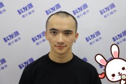 -大麦微针植发丨全国连锁